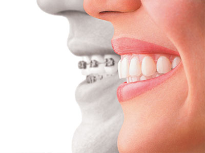OB1 Dental | Implant Dentistry, Dental Cleanings and TMJ Disorders